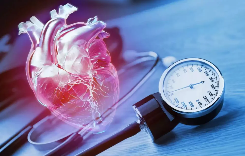 Hipertensión arterial.