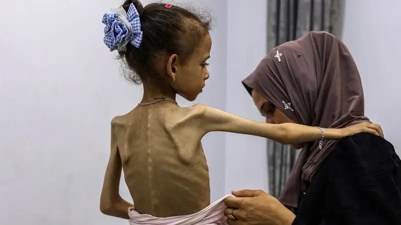 hambruna en la Franja de Gaza. 