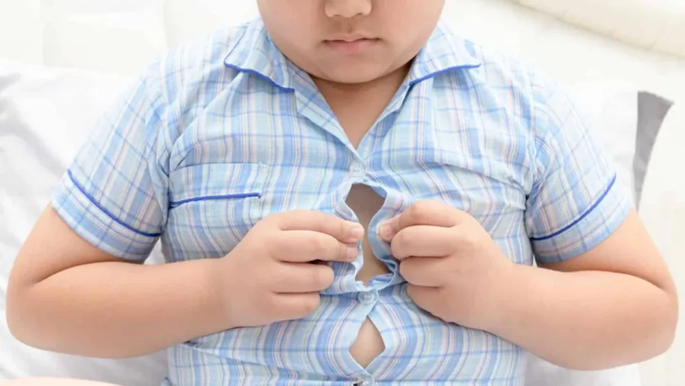 Obesidad infantil.