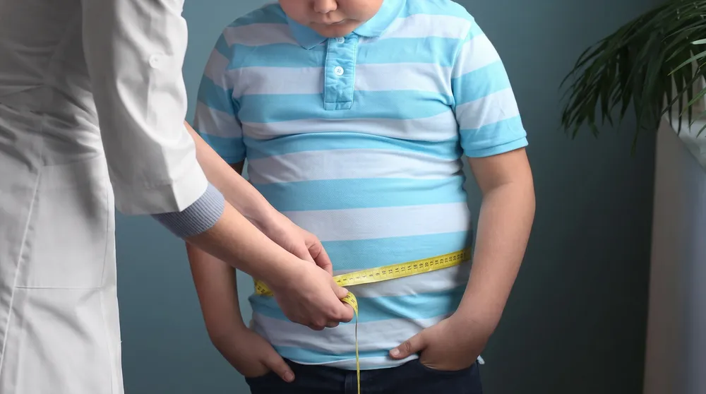 Obesidad infantil.